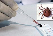 Balochistan: Congo virus takes another life in Quetta