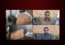 Balochistan journalists tortured for news story against Military’s corruption