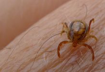 Congo Virus Claims Another Life As Death Toll Rises To Ten