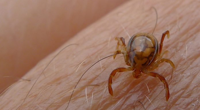 Congo Virus Claims Another Life As Death Toll Rises To Ten