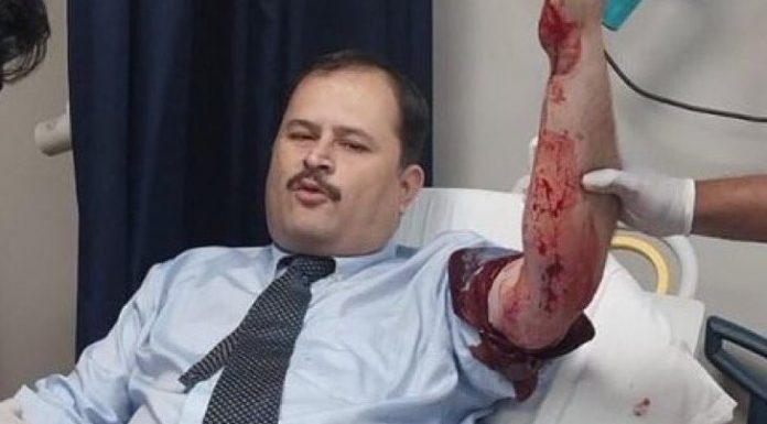 Karachi: Prominent Journalist Injured in Targeted Attack