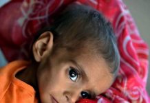 Severe Child Malnutrition Crisis Deepens in Balochistan Amid Poverty and Lack of Basic Services