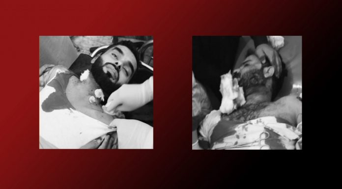 Kharan: Lecturer Killed, Another Injured in Shooting at UoB Sub-Campus
